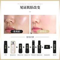 慧立康 铂金焕颜弹性鱼子水150ml 珍稀精粹、精华汇集、深层锁水、修护肌肤、重焕肌肤光泽弹性