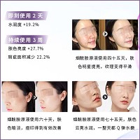 圣玛歌 烟酰胺植萃液30ml(亮白原液)减淡痘印及黑点、提亮肤色、预防瑕疵生成