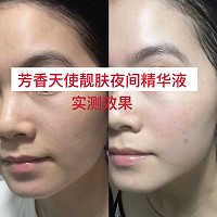 芳香天使 靓肤夜间精华液15ml 亮白亮肤、均匀肤色、莹润皙滑